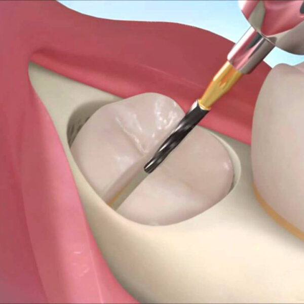 Cirugia oral 1